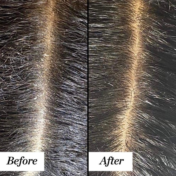 Sunday Riley Clean Rinse Clarifying Scalp Serum, 4 fl. Oz - Picture 5 of 9